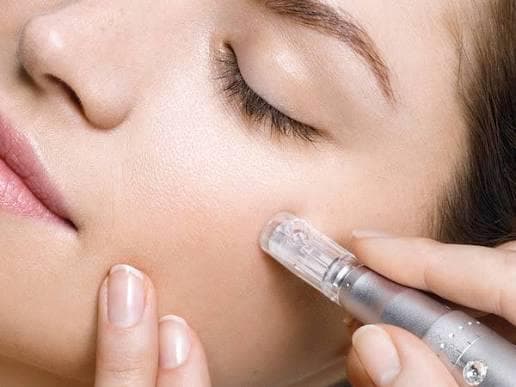 PRP Microneedling